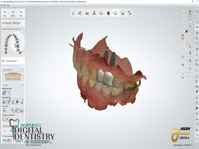 نرم افزار دندانپزشکی تری شیپ دنتال سیستم (3Shape Dental System)