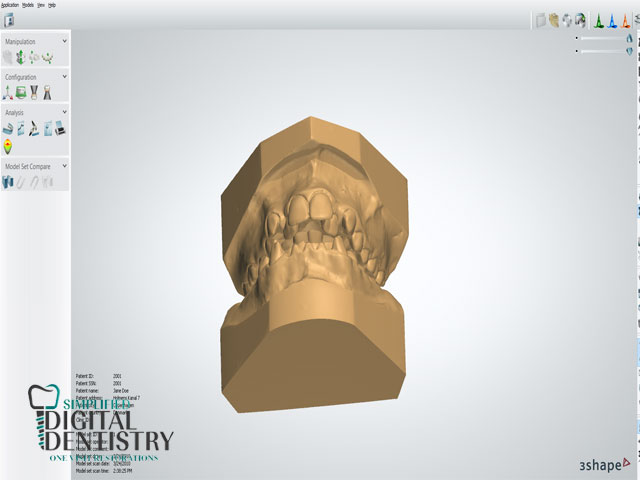 نرم افزار دندانپزشکی 3SHAPE ORTHO