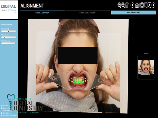 نرم افزار دندانپزشکی Digital Smile System