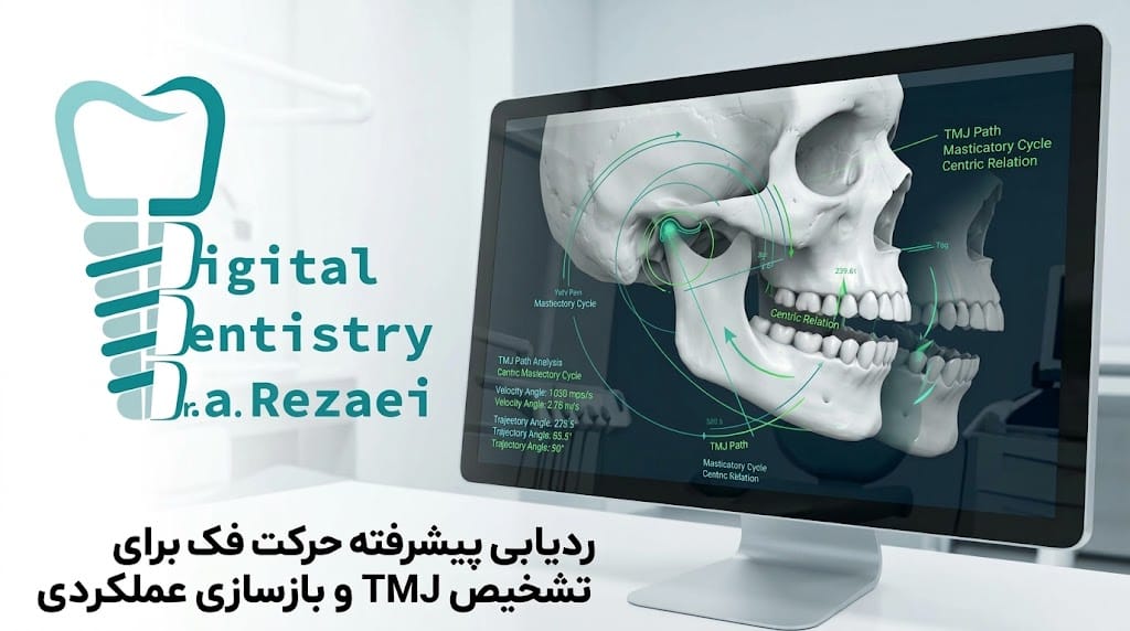 ردیابی حرکت فک