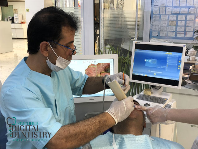 اسکنر داخل دهانی دیجیتال