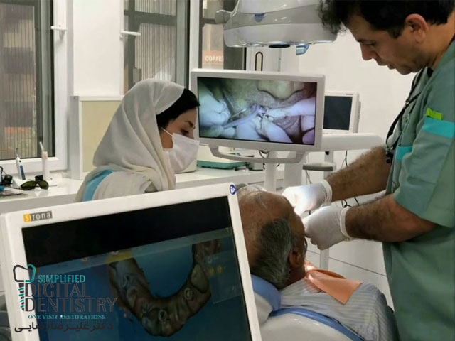 ایمپلنت در رشت