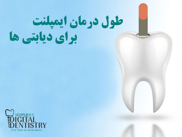 طول درمان ایمپلنت بیماران دیابتی