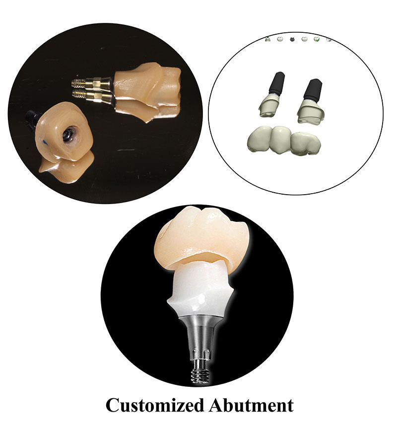 پروتز دیجیتال
