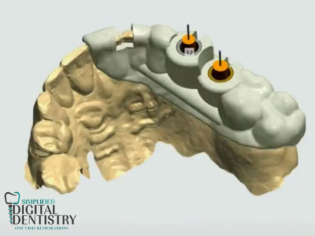 سرجیکال گاید