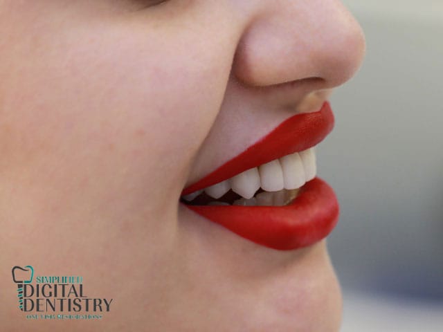 تفاوت بلیچینگ ،جرمگیری و لمینت