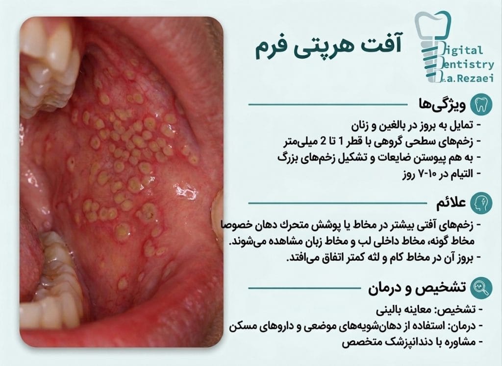 آفت هرپتی‌ فرم