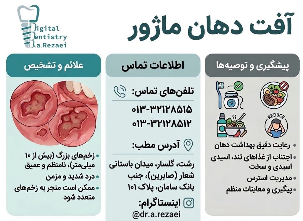 آفت ماژور
