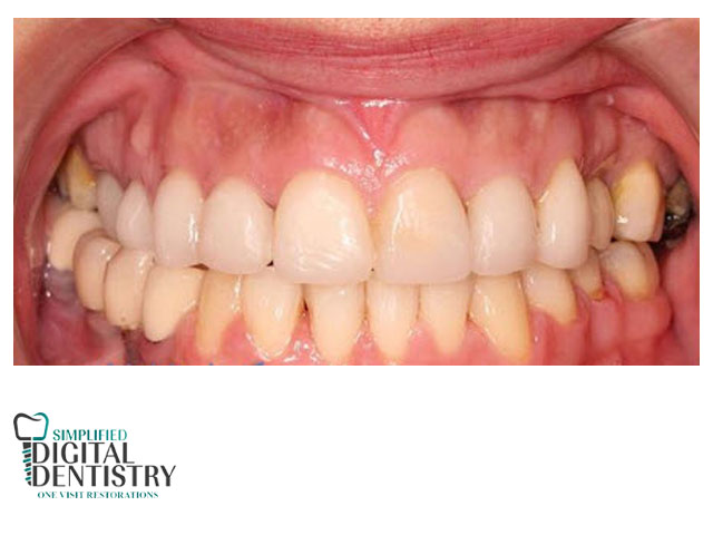 ارتودنسی به سبک دیجیتال