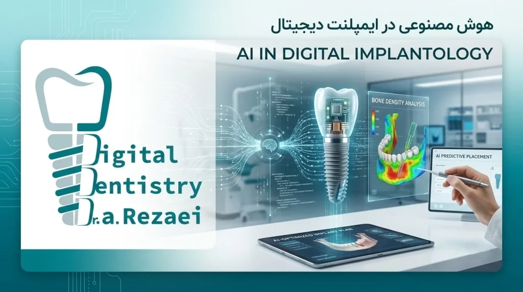 هوش مصنوعی در ایمپلنت